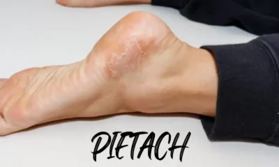 Pietach