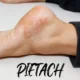 Pietach